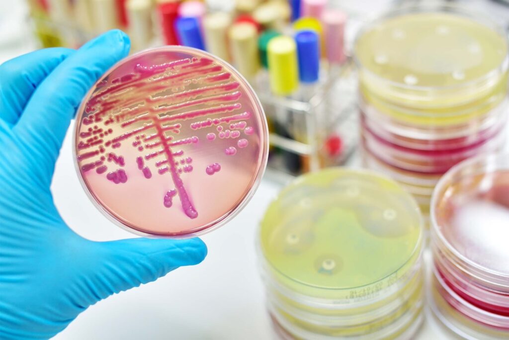 a bacterial culture on a plate
