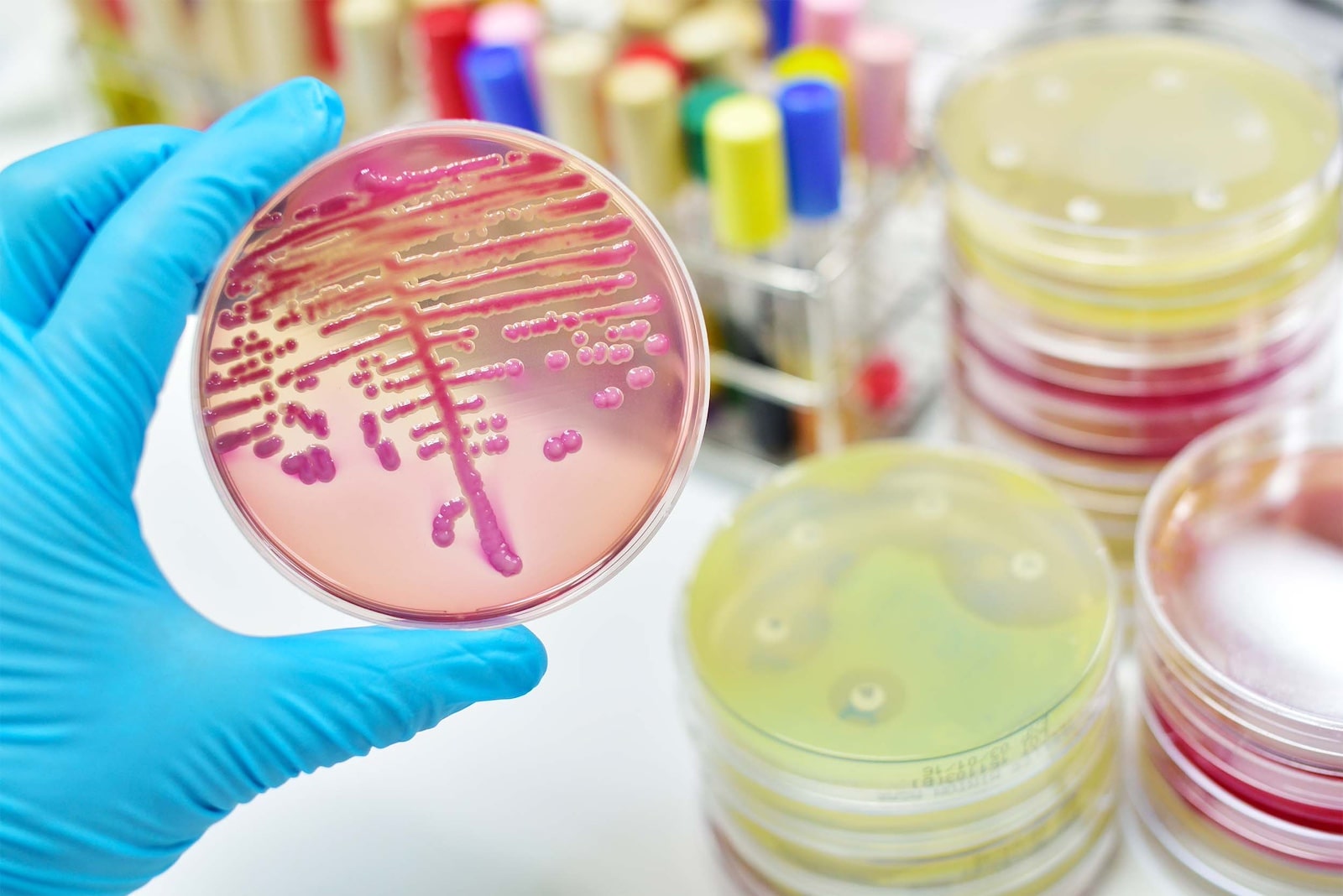 a bacterial culture on a plate